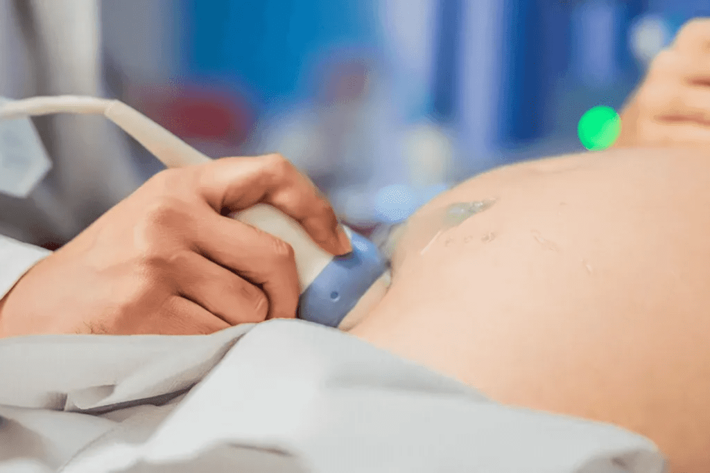 Grávida fazendo ultrassom.