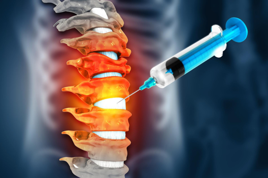 Bloqueio das dores com infiltrações.