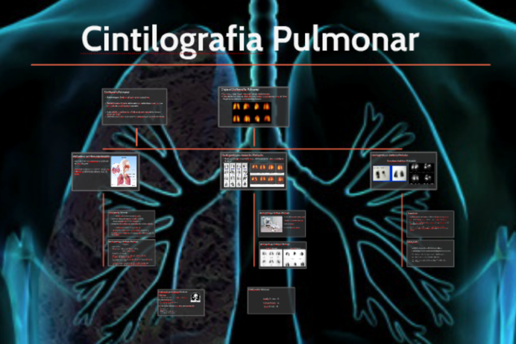 Cintilografia pulmonar.