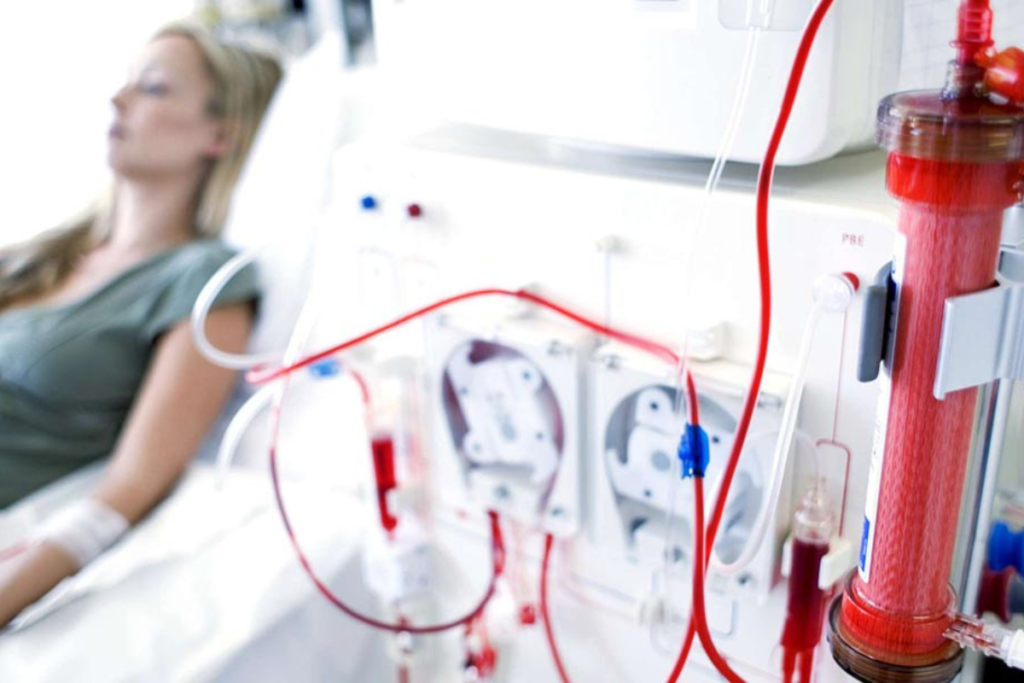Mulher fazendo hemodiálise em hospital.