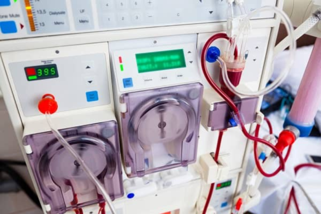 Aparelho para hemodiálise no hospital.