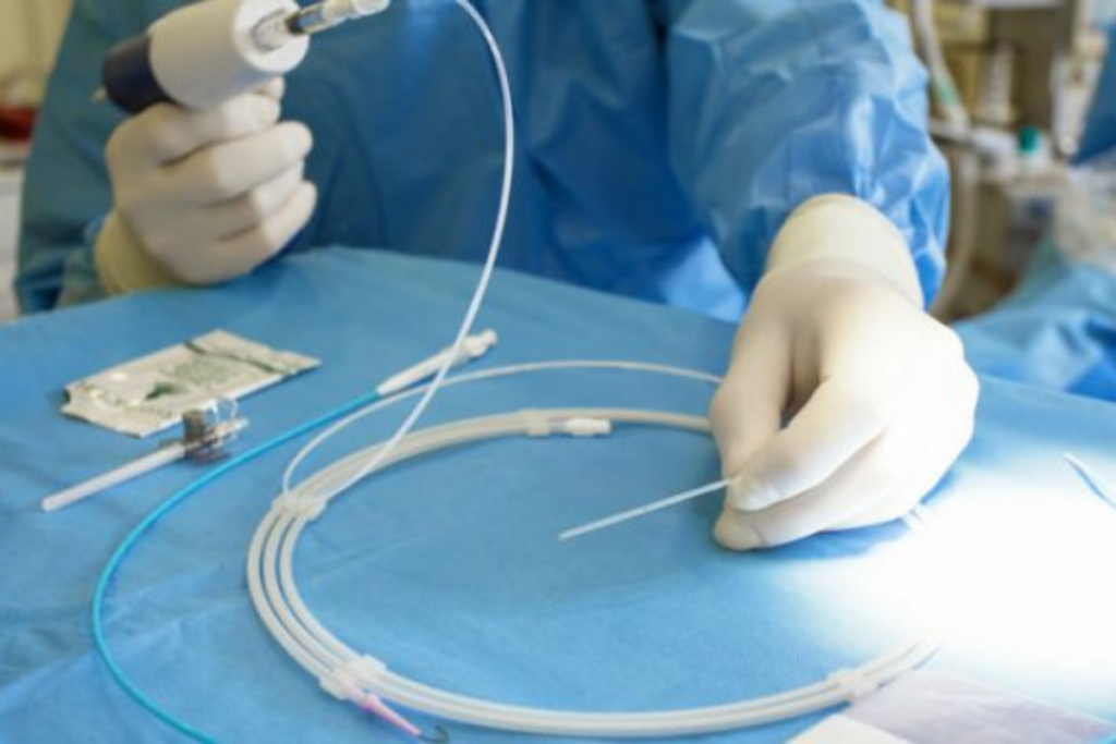 Cateterismo cardíaco nos planos de saúde.